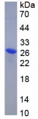 SDS PAGE (PDE4DIP-2566H).jpg